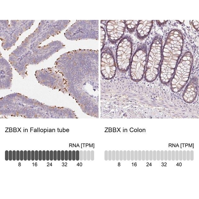 Anti-ZBBX antibody produced in rabbit