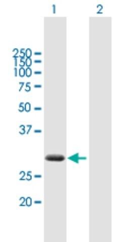 Anti-ZBED2 antibody produced in mouse