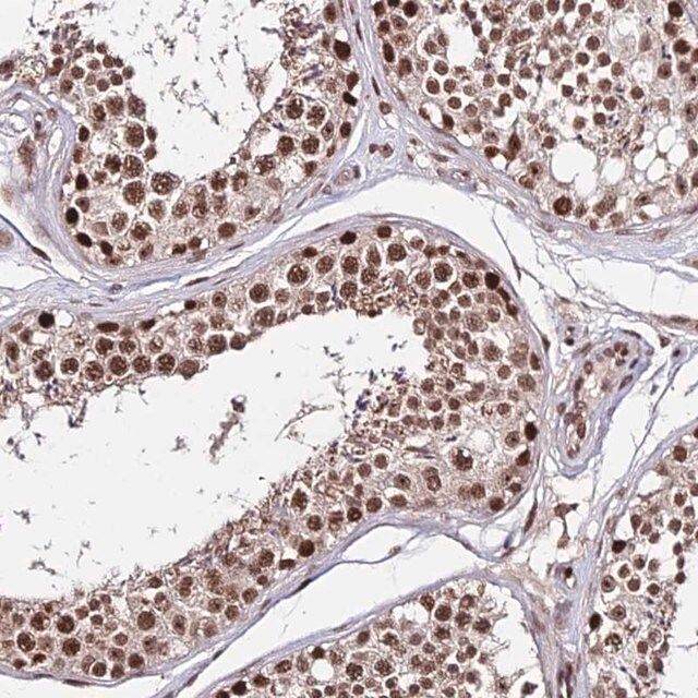 Anti-ZBED4 antibody produced in rabbit