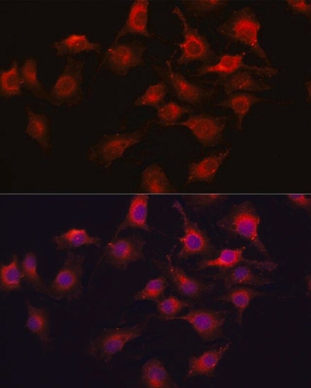 Anti-VEGFA antibody produced in rabbit