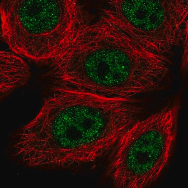 Anti-VDR antibody produced in rabbit