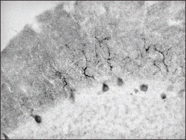 Anti-VILIP-3 antibody produced in rabbit