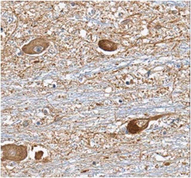 Anti-Versican Antibody, clone 8D8.1