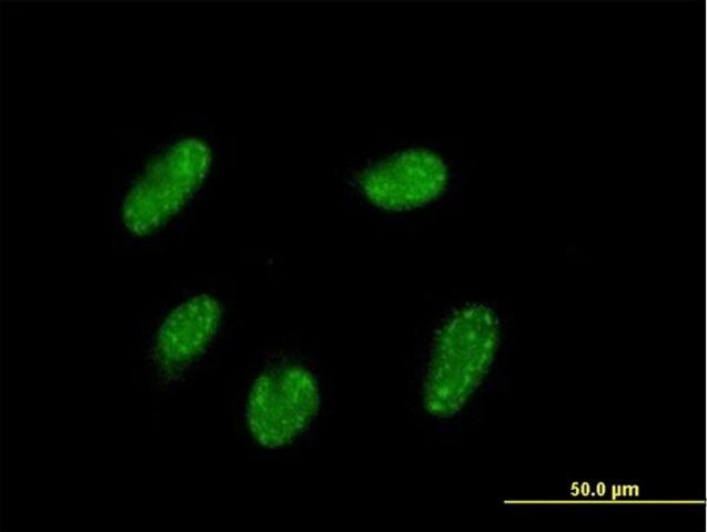 Anti-VENTX antibody produced in mouse