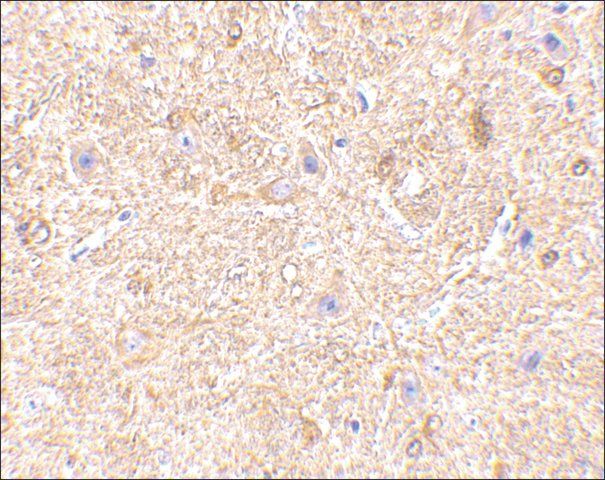 Anti-VISA (AB2) antibody produced in rabbit