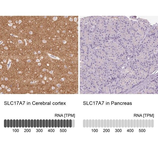 Anti-VGLUT1 antibody produced in rabbit