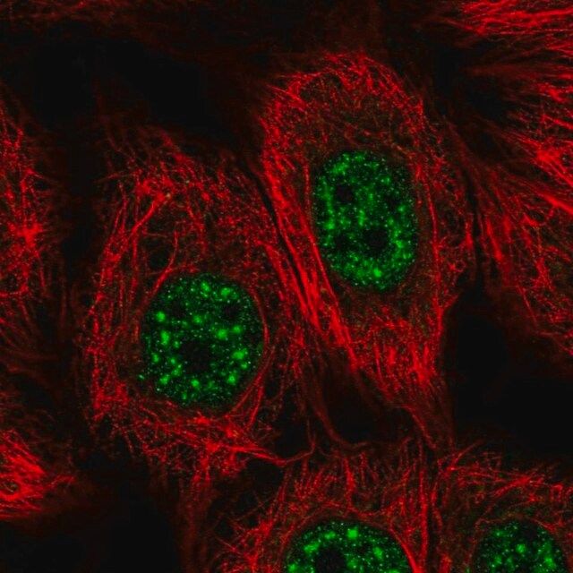 Anti-VPS72 antibody produced in rabbit