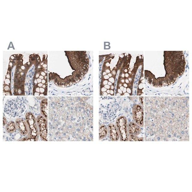 Anti-VIL1 antibody produced in rabbit