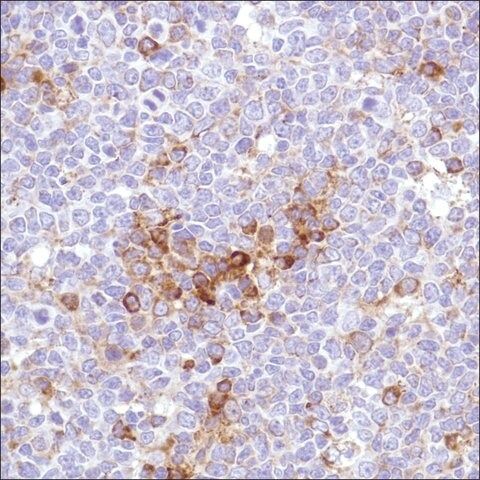 Anti-VPAC1 antibody, Rabbit monoclonal