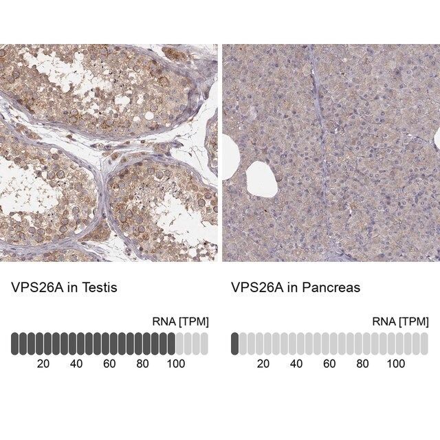 Anti-VPS26A antibody produced in rabbit