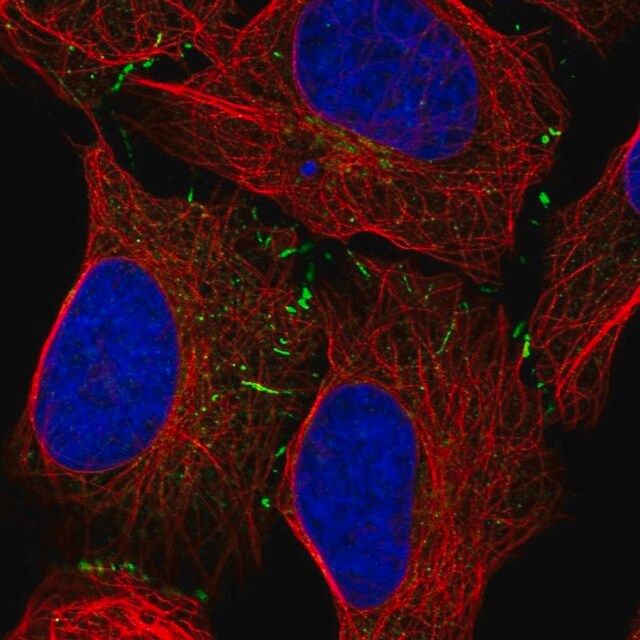 Anti-VPS13B antibody produced in rabbit