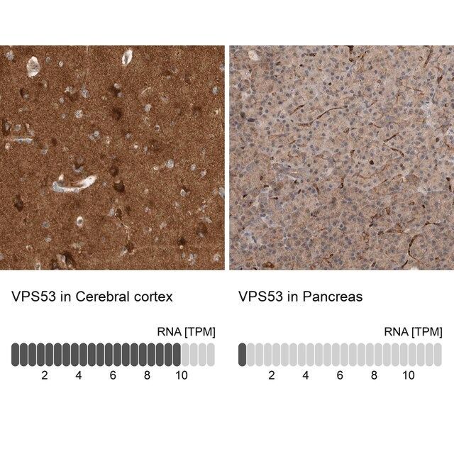 Anti-VPS53 antibody produced in rabbit