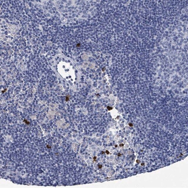 Anti-VPS13D antibody produced in rabbit