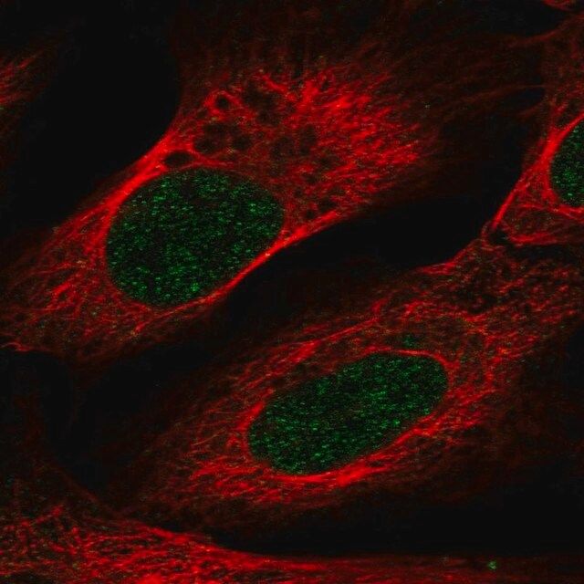 Anti-VSIG10L antibody produced in rabbit