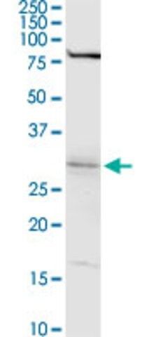 Anti-WBSCR22 antibody produced in rabbit