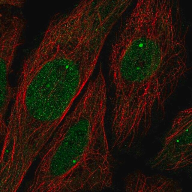 Anti-UBN1 antibody produced in rabbit