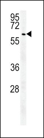 ANTI-UBP17(C-TERMINAL) antibody produced in rabbit