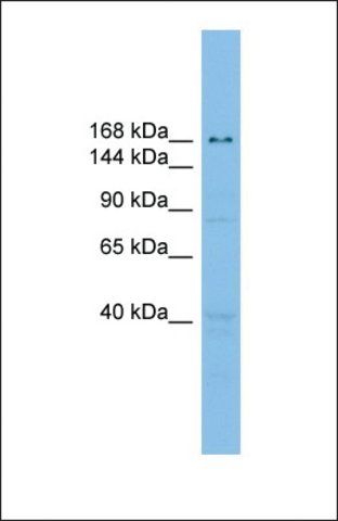 Anti-UBE2O antibody produced in rabbit