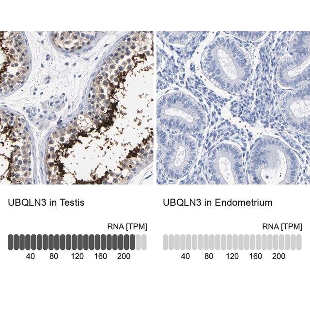 Anti-UBQLN3 antibody produced in rabbit