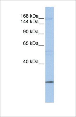 Anti-UBR2 antibody produced in rabbit