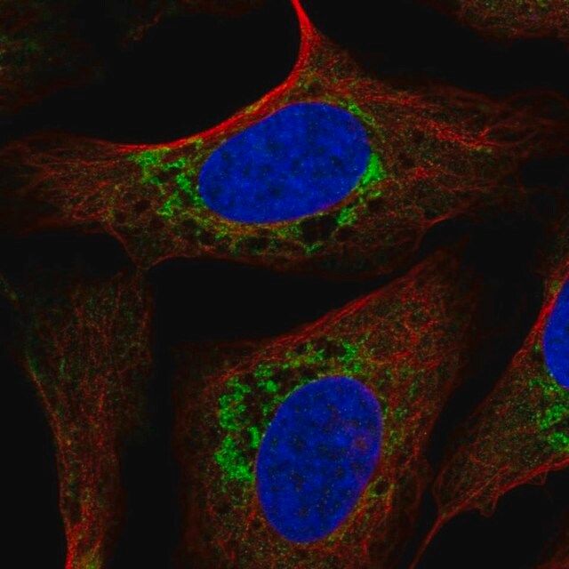 Anti-USMG5 antibody produced in rabbit