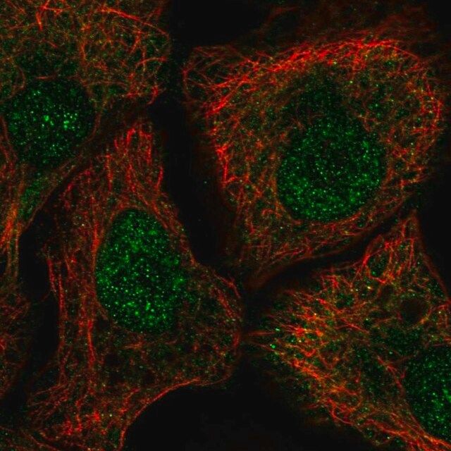 Anti-TUT1 antibody produced in rabbit