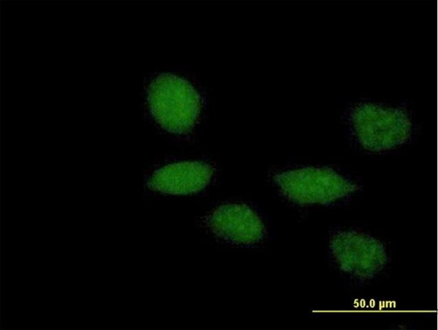 Anti-TWIST1 antibody produced in mouse