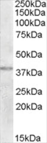 Anti-TXL2/TXNDC6 antibody produced in goat