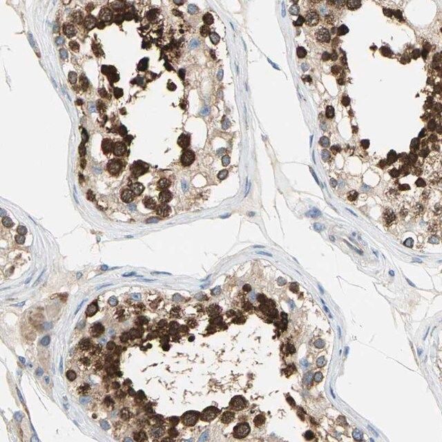 Anti-TULP4 antibody produced in rabbit