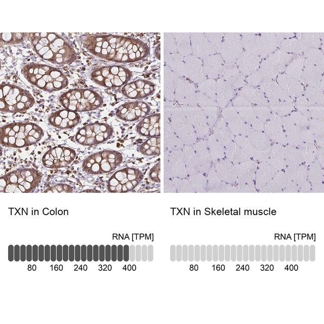 Anti-TXN antibody produced in rabbit