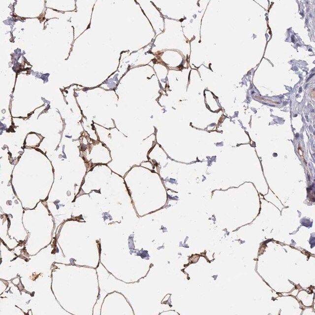 Anti-TUSC5 antibody produced in rabbit