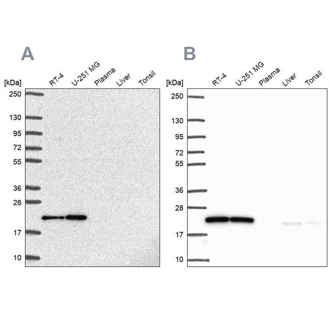 Anti-UBE2M antibody produced in rabbit