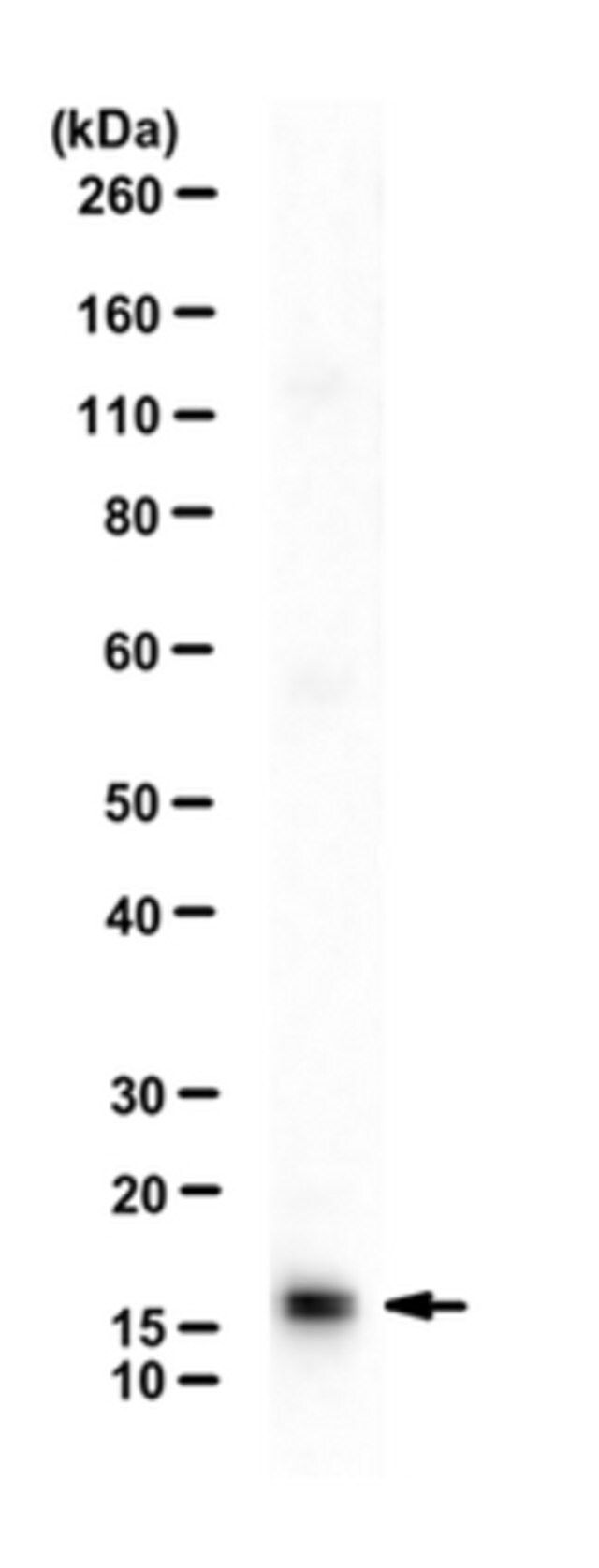 Anti-Ubiquitin-conjugating enzyme E2 A Antibody