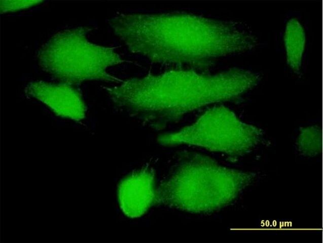 Anti-TRIM21 antibody produced in mouse