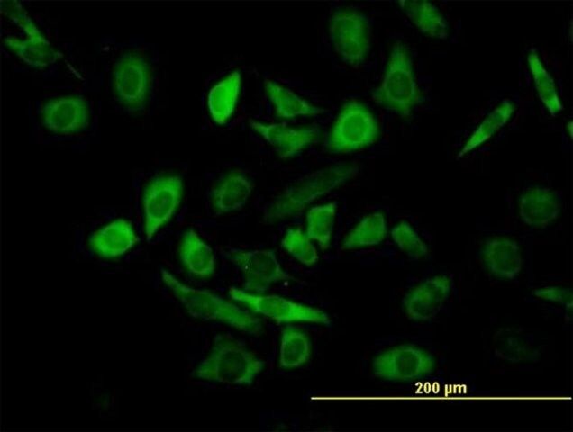 ANTI-TRIM25 antibody produced in mouse