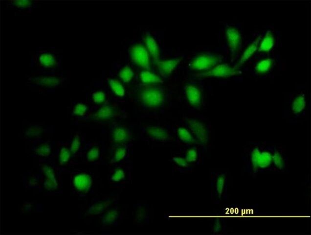 Anti-TRIM39 antibody produced in mouse