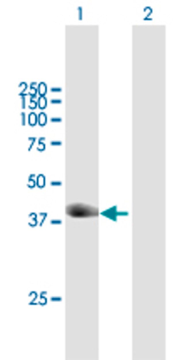 Anti-TRIM63 antibody produced in mouse