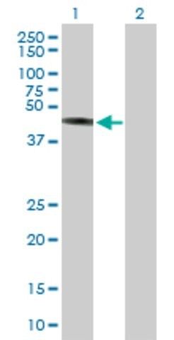 Anti-TRIM44 antibody produced in mouse