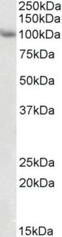 Anti-TRIM71 antibody produced in goat