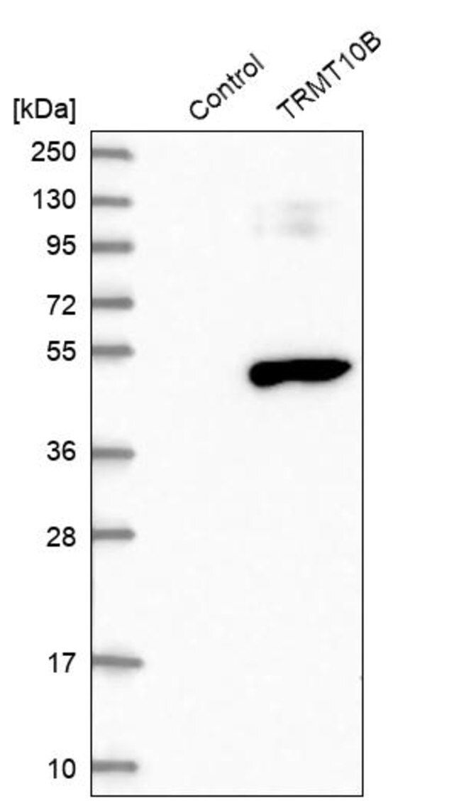 Anti-TRMT10B antibody produced in rabbit