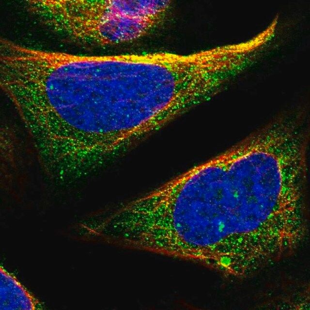 Anti-TOM1 antibody produced in rabbit