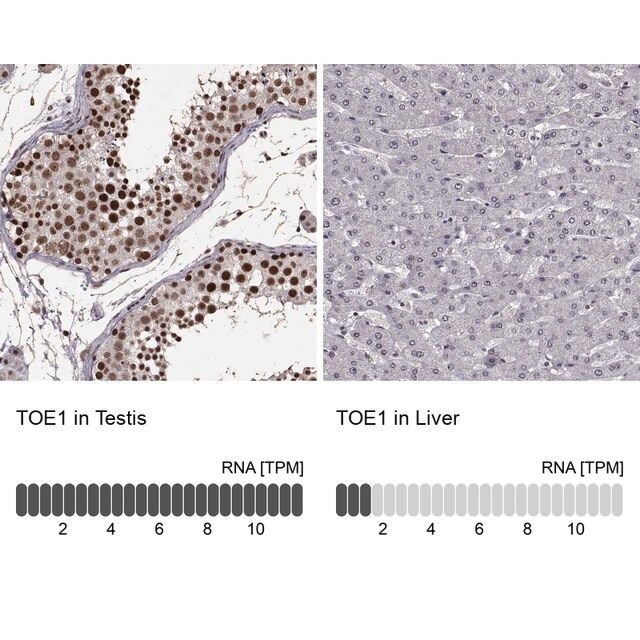 Anti-TOE1 antibody produced in rabbit