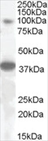 Anti-THRAP4/MED24 antibody produced in goat