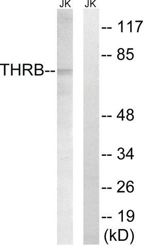 Anti-THRB (AP2, Cleaved-Arg<sup>327</sup>) antibody produced in rabbit