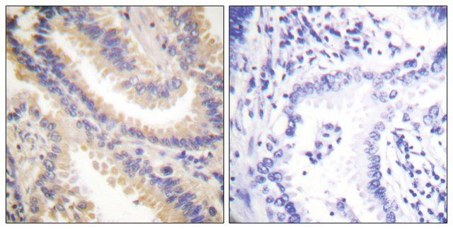 Anti-TIMP4, C-Terminal antibody produced in rabbit