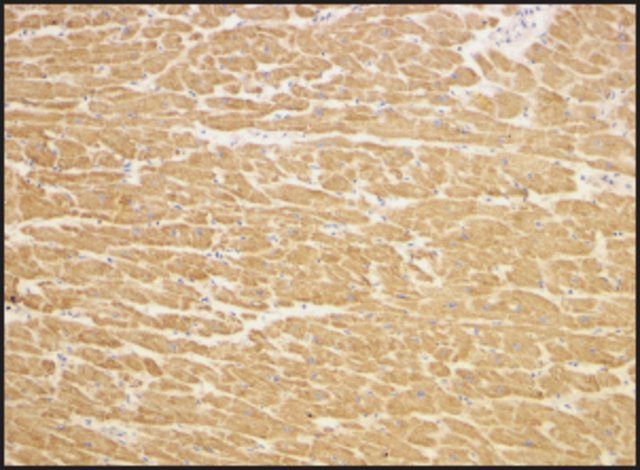 Anti-TIRAP (AB2) antibody produced in rabbit