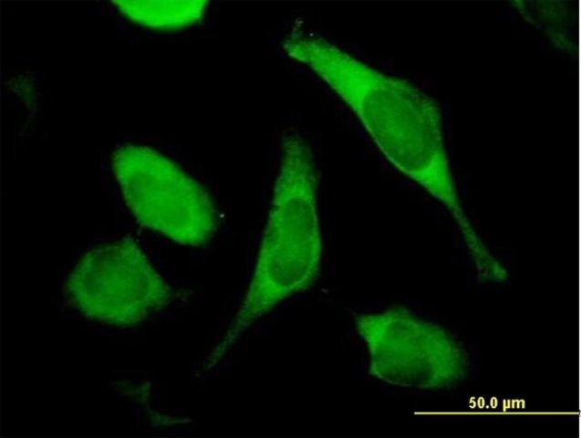 Anti-TIMM8A antibody produced in mouse