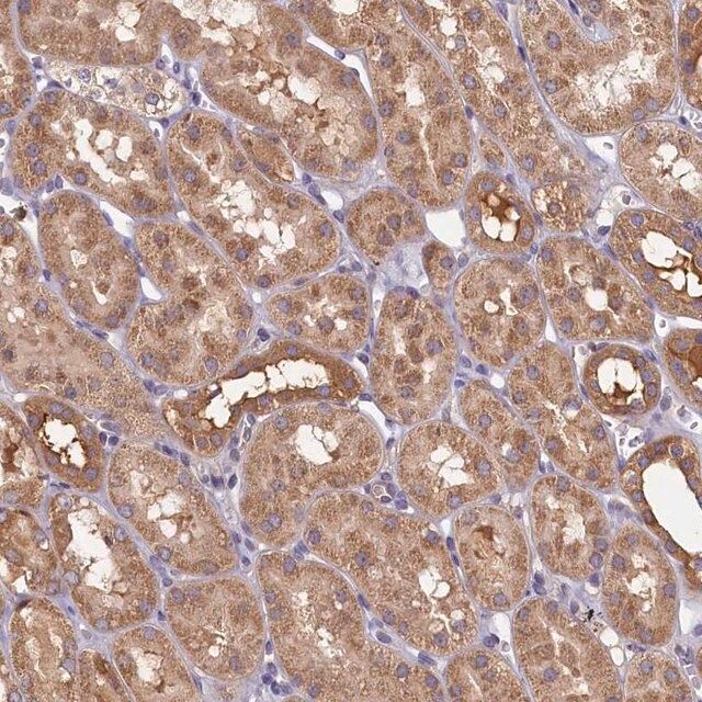 Anti-TIMM8B antibody produced in rabbit