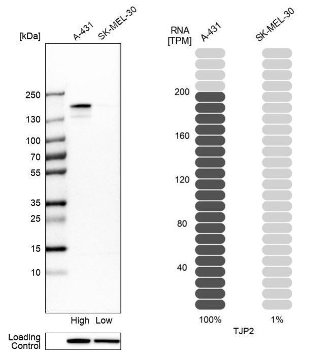 Anti-TJP2 antibody produced in rabbit