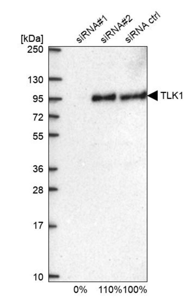 Anti-TLK1 antibody produced in rabbit